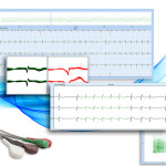 holter-software