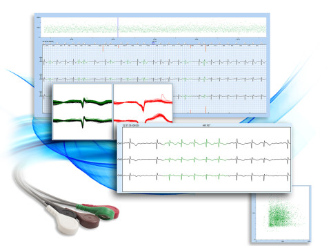 SEIVA nabízí EKG holter